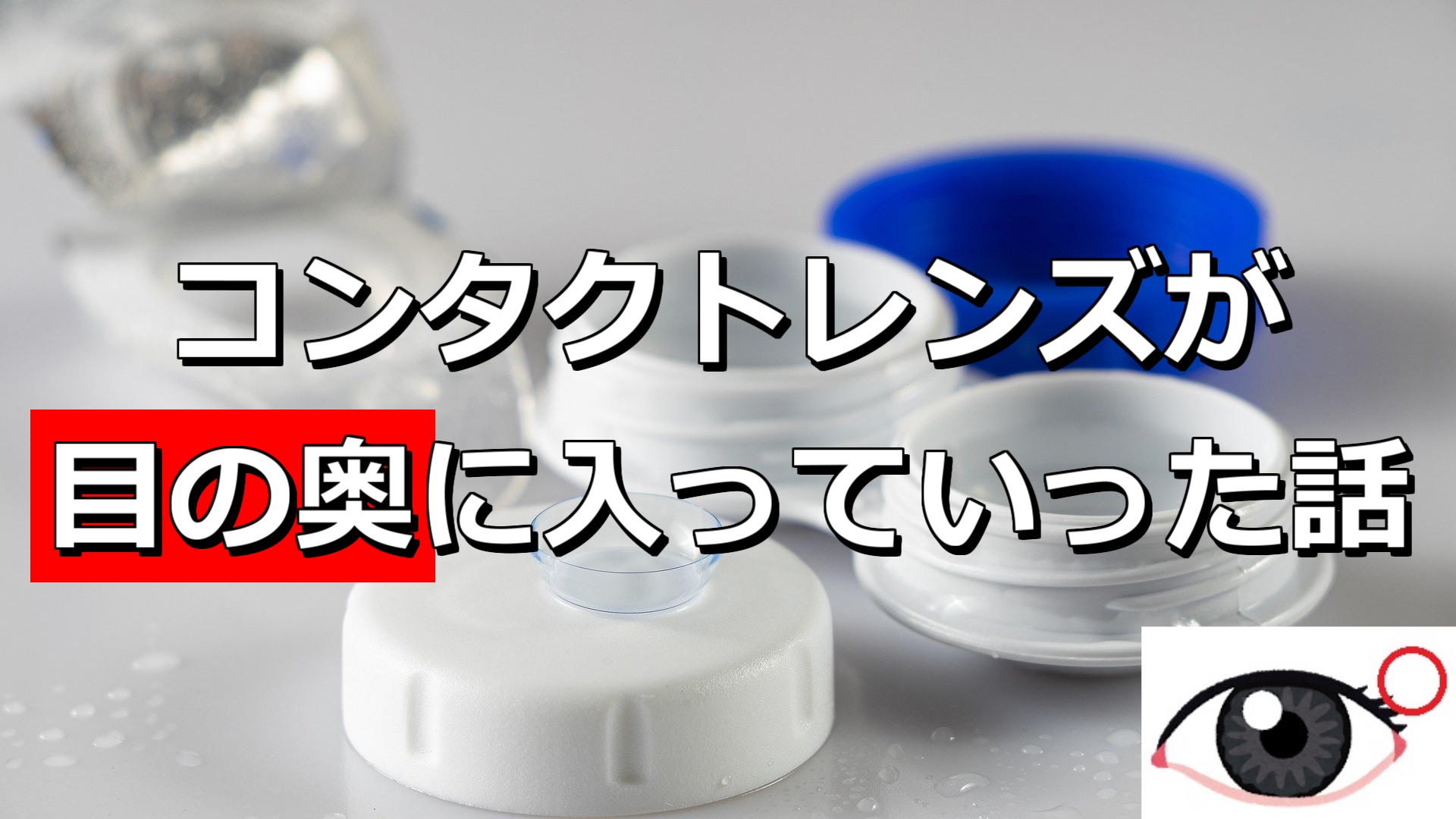 Q1 コンタクトレンズについて教えてください 独立行政法人 医薬品医療機器総合機構